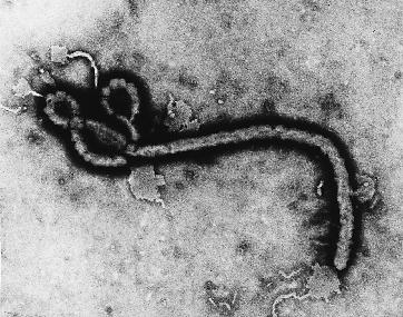 ebola zaire.jpg